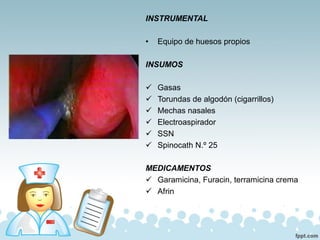 INSTRUMENTAL
• Equipo de huesos propios
INSUMOS
✓ Gasas
✓ Torundas de algodón (cigarrillos)
✓ Mechas nasales
✓ Electroaspirador
✓ SSN
✓ Spinocath N.º 25
MEDICAMENTOS
✓ Garamicina, Furacin, terramicina crema
✓ Afrin
 