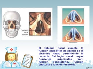El tabique nasal cumple la
función específica de sostén de la
pirámide nasal, permitiendo la
correcta fisiología nasal, cuyas
funciones principales son:
función ventilatoria, función
olfatoria y función fonatoria.
 