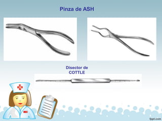 Pinza de ASH
Disector de
COTTLE
 