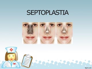 SEPTOPLASTIA
 