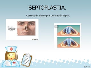 SEPTOPLASTIA.
Corrección quirúrgica DesviaciónSeptal.
 