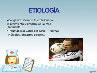 ETIOLOGÍA
•Congénita: Desarrollo embrionario.
•Crecimiento y desarrollo: La mas
frecuente.
•Traumáticas: Canal del parto. Traumas
Múltiples, impactos directos.
 
