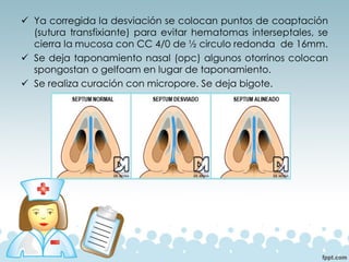 ✓ Ya corregida la desviación se colocan puntos de coaptación
(sutura transfixiante) para evitar hematomas interseptales, se
cierra la mucosa con CC 4/0 de ½ circulo redonda de 16mm.
✓ Se deja taponamiento nasal (opc) algunos otorrinos colocan
spongostan o gelfoam en lugar de taponamiento.
✓ Se realiza curación con micropore. Se deja bigote.
 