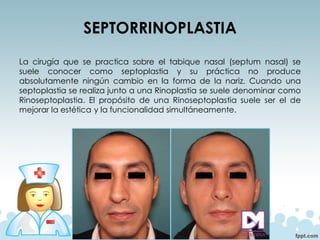 SEPTORRINOPLASTIA
La cirugía que se practica sobre el tabique nasal (septum nasal) se
suele conocer como septoplastia y su práctica no produce
absolutamente ningún cambio en la forma de la nariz. Cuando una
septoplastia se realiza junto a una Rinoplastia se suele denominar como
Rinoseptoplastia. El propósito de una Rinoseptoplastia suele ser el de
mejorar la estética y la funcionalidad simultáneamente.
 