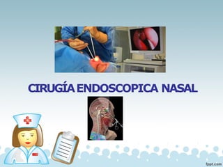 CIRUGÍAENDOSCOPICA NASAL
 