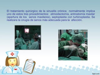 El tratamiento quirúrgico de la sinusitis crónica normalmente implica
uno de estos tres procedimientos: etmoidectomía, antrostomía maxilar
(apertura de los senos maxilares), septoplastia con turbinoplastia. Se
realizara la cirugía de senos más adecuada para la afección.
 