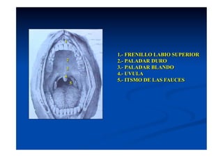 1


        1.- FRENILLO LABIO SUPERIOR
2       2.- PALADAR DURO
3       3.- PALADAR BLANDO
4
        4.- UVULA
        5.- ITSMO DE LAS FAUCES
    5
 