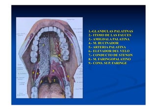 1.-GLANDULAS PALATINAS
                                2.- ITSMO DE LAS FAUCES
                                3.- AMIGDALA PALATINA
                                4.- M. BUCINADOR
            1               7
                                5.- ARTERIA PALATINA
                                6.- ELEVADOR DEL VELO
                    5           7.- CONDUCTO DE STENON
                                8.- M. FARINGOPALATINO
                                9.- CONS. SUP. FARINGE

                8
4   6
                        9
        3       2
 