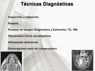 Técnicas Diagnósticas
Inspección y palpación.
Biopsia.
Pruebas de Imagen Diagnostica y Extensión: TC, RM.
Fibroscopia tracto aerodigestivo
Ultrasonido abdominal
Gammagrama oseo de cuerpo entero
 