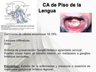 CA de Piso de la
Lengua
Carcinoma de células escamosas 10-15%.
Lesiones infiltrativas.
Dolor.
Síntoma de presentación: Ganglio linfático agrandado cervical.
Pueden crecer hasta un tamaño masivo, sin metástasis a ganglios
linfáticos cervicales.
Pronóstico: Estadio de la enfermedad y presencia o ausencia de
metástasis ganglionar linfática regional.
 