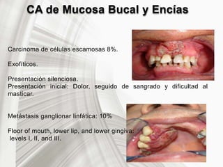 CA de Mucosa Bucal y Encías
Carcinoma de células escamosas 8%.
Exofíticos.
Presentación silenciosa.
Presentación inicial: Dolor, seguido de sangrado y dificultad al
masticar.
Metástasis ganglionar linfática: 10%
Floor of mouth, lower lip, and lower gingiva:
levels I, II, and III.
 