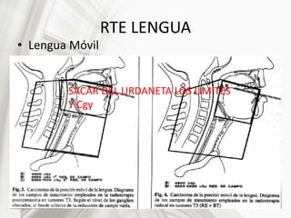 RTE LENGUA
• Lengua Móvil
SACAR DEL URDANETA LOS LIMITES
Y Cgy
 