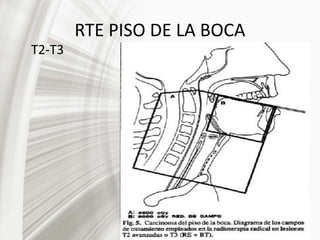 RTE PISO DE LA BOCA
T2-T3
 