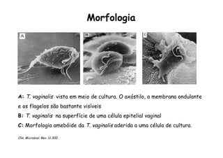 A: T. vaginalis vista em meio de cultura. O axóstilo, a membrana ondulante
e os flagelos são bastante visíveis
B: T. vaginalis na superfície de uma célula epitelial vaginal
C: Morfologia amebóide da T. vaginalis aderida a uma célula de cultura.
Clin. Microbiol. Rev. 11:300
Morfologia
 