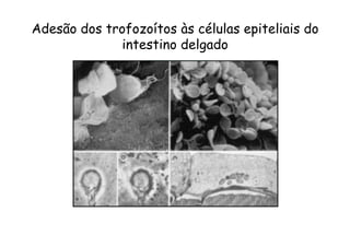 Adesão dos trofozoítos às células epiteliais do
intestino delgado
 
