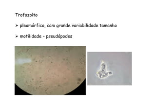 Trofozoíto
Ø  pleomórfico, com grande variabilidade tamanho
Ø  motilidade – pseudópodes
 