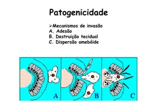 Amebíase
Patogenicidade
Ø Mecanismos de invasão
A.  Adesão
B.  Destruição tecidual
C.  Dispersão amebóide
extra-intestinal
 