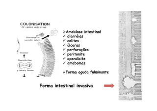 Forma intestinal
Forma intestinal invasiva
Ø Amebíase intestinal
ü  diarréias
ü  colites
ü  úlceras
ü  perfurações
ü  peritonite
ü  apendicite
ü  amebomas
Ø Forma aguda fulminante
 