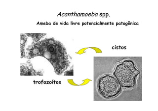 Acanthamoeba spp.
trofozoítos
cistos
Ameba de vida livre potencialmente patogênica
 
