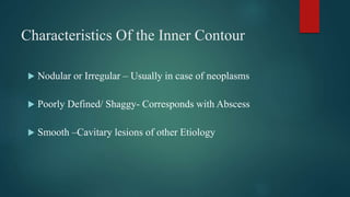 cavitatorylungdiseaseultimate-220410071917.pdf