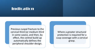 Cuspal Protection cavity design principles in fixed prothesis | PDF