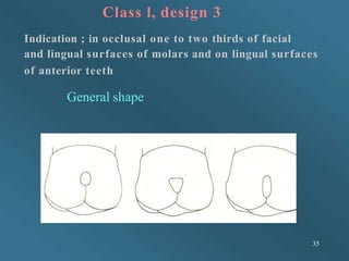 Class l, design 3
Indication ; in occlusal one to two thirds of facial
and lingual surfaces of molars and on lingual surfa...