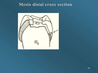 Mesio distal cross section
40
 