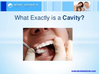 www.dentaloptimizer.com
What Exactly is a Cavity?
 