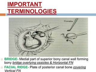 IMPORTANT
TERMINOLOGIES
 BRIDGE- Medial part of superior bony canal wall forming
bony bridge overlying ossicles & Horizontal FN
 FACIAL RIDGE- Plate of posterior canal bone covering
Vertical FN
 