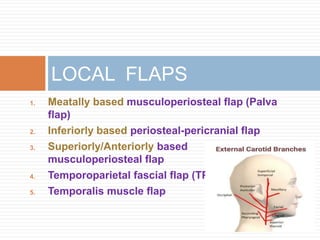 1. Meatally based musculoperiosteal flap (Palva
flap)
2. Inferiorly based periosteal-pericranial flap
3. Superiorly/Anteriorly based
musculoperiosteal flap
4. Temporoparietal fascial flap (TPFF)
5. Temporalis muscle flap
LOCAL FLAPS
 