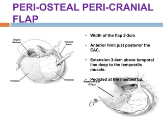 PERI-OSTEAL PERI-CRANIAL
FLAP
• Width of the flap 2-3cm
• Anterior limit just posterior the
EAC.
• Extension 3-4cm above temporal
line deep to the temporalis
muscle.
• Pedicled at the mastoid tip.
 
