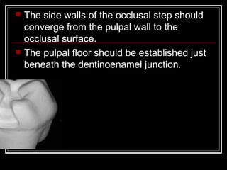  The side walls of the occlusal step should 
converge from the pulpal wall to the 
occlusal surface. 
 The pulpal floor should be established just 
beneath the dentinoenamel junction. 
 