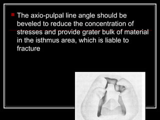  The axio-pulpal line angle should be 
beveled to reduce the concentration of 
stresses and provide grater bulk of material 
in the isthmus area, which is liable to 
fracture 
 