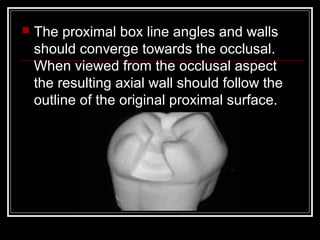  The proximal box line angles and walls 
should converge towards the occlusal. 
When viewed from the occlusal aspect 
the resulting axial wall should follow the 
outline of the original proximal surface. 
 