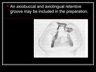  An axiobuccal and axiolingual retentive 
groove may be included in the preparation. 
 
