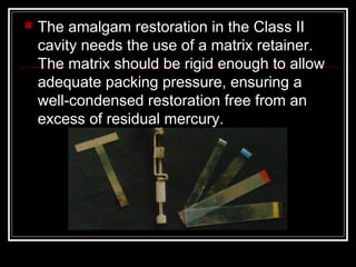  The amalgam restoration in the Class II 
cavity needs the use of a matrix retainer. 
The matrix should be rigid enough to allow 
adequate packing pressure, ensuring a 
well-condensed restoration free from an 
excess of residual mercury. 
 