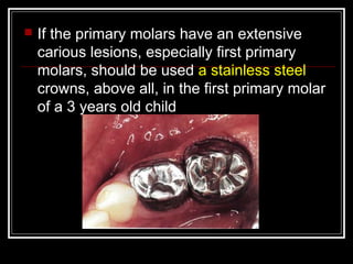  If the primary molars have an extensive 
carious lesions, especially first primary 
molars, should be used a stainless steel 
crowns, above all, in the first primary molar 
of a 3 years old child 
 