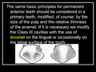 The same basic principles for permanent 
anterior teeth should be considered in a 
primary teeth, modified, of course, by the 
size of the pulp and the relative thinness 
of the enamel. If it is necessary we modify 
the Class III cavities with the use of 
dovetail on the lingual or occasionally on 
the labial surface of the tooth. 
 