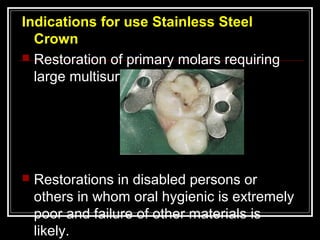 Indications for use Stainless Steel
  Crown
 Restoration of primary molars requiring
  large multisurface restoration.




   Restorations in disabled persons or
    others in whom oral hygienic is extremely
    poor and failure of other materials is
    likely.
 