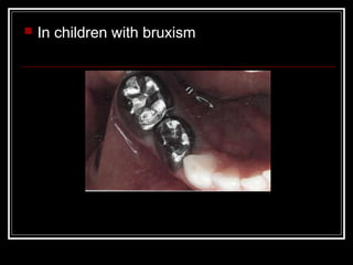    In children with bruxism
 