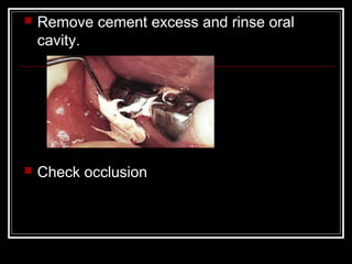    Remove cement excess and rinse oral
    cavity.




   Check occlusion
 