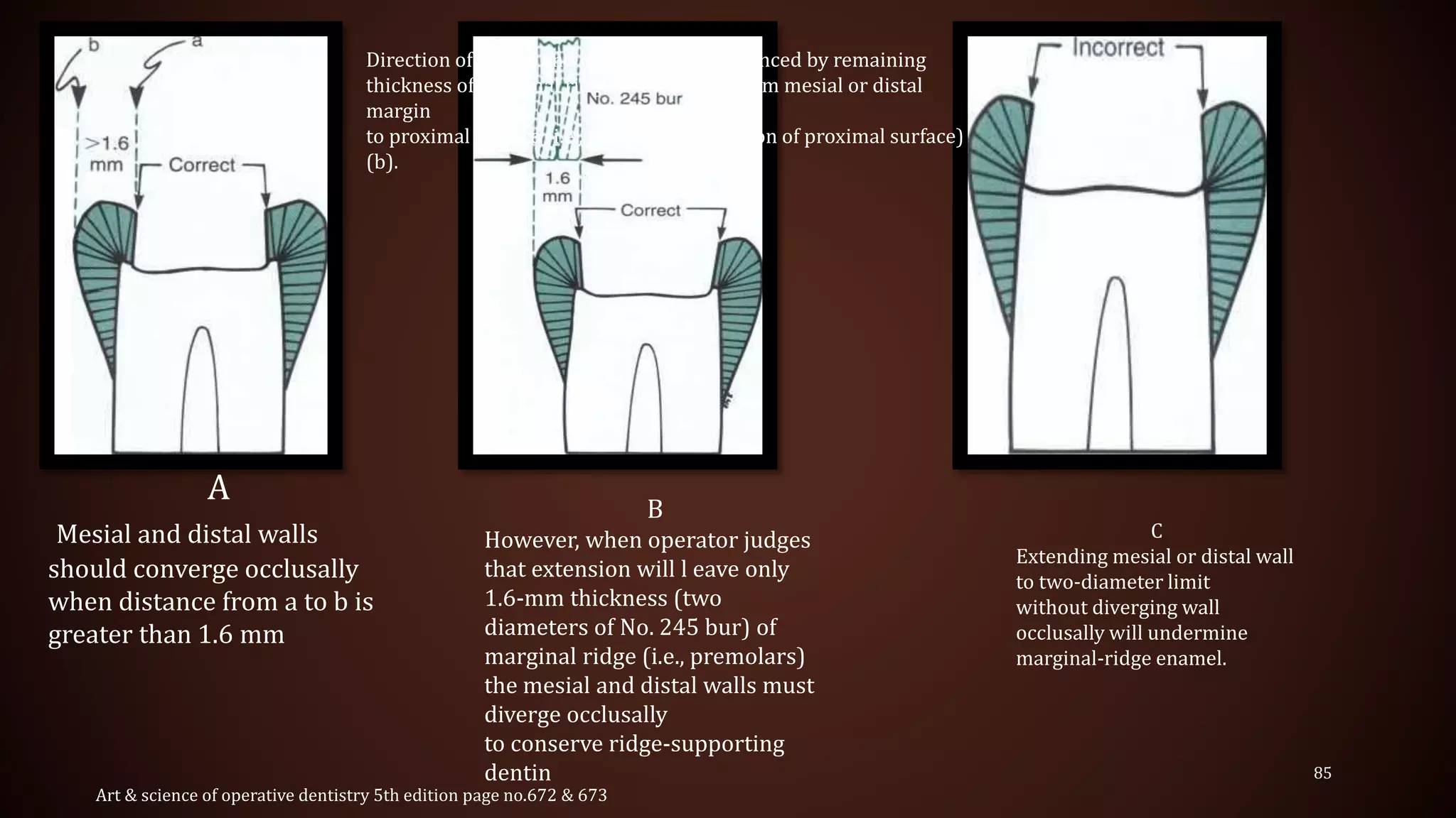 Cavity preparation | PPTX