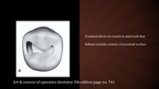 Proximal ditch cut results in axial wall that
follows outside contour of proximal surface
Art & science of operative dentistry 5th edition page no. 741
 