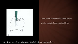 Facio lingual dimension of proximal ditch is
greater at gingival than at occlusal level.
Art & science of operative dentistry 5th edition page no. 741
 