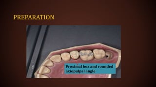 PREPARATION
Proximal box and rounded
axiopulpal angle
 