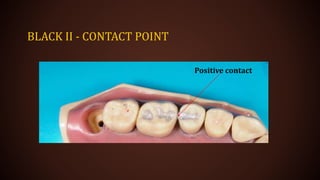 BLACK II - CONTACT POINT
Positive contact
 