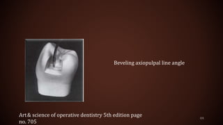 121
Beveling axiopulpal line angle
Art& science of operative dentistry 5th edition page
no. 705
 