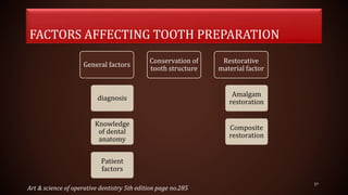 FACTORS AFFECTING TOOTH PREPARATION
General factors
diagnosis
Knowledge
of dental
anatomy
Patient
factors
Conservation of
tooth structure
Restorative
material factor
Amalgam
restoration
Composite
restoration
37
Art & science of operative dentistry 5th edition page no.285
 