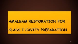 AMALGAM RESTORATION FOR
CLASS I CAVITY PREPARATION
46
 