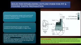 RULES FOR ESTABLISHING OUTLINE FORM FOR PIT &
FISSURE TOOTH PREPARATION
1.Extend the preparation margin until sound tooth
structure is obtained and no unsupported and/or
weakened enamel remains.
2. Avoid terminating the margin on extreme
eminences such as cusp heights or ridge crests.
3. If the extension from a primary groove includes one
half or more of the cusp incline, consideration should
be given to capping the cusp. If the extension is two-
thirds, the cusp-capping procedure is most often the
proper procedure ,which removes the margin from
the area of masticatory stresses.
Rule for cusp capping: If extension from a primary groove toward the cusp tip is no
more than half the distance, then no cusp capping; if this extension is from one half to two
thirds of the distance, then consider cusp capping; if the extension is more than two thirds
of the distance, then usually cap the cusp.
 